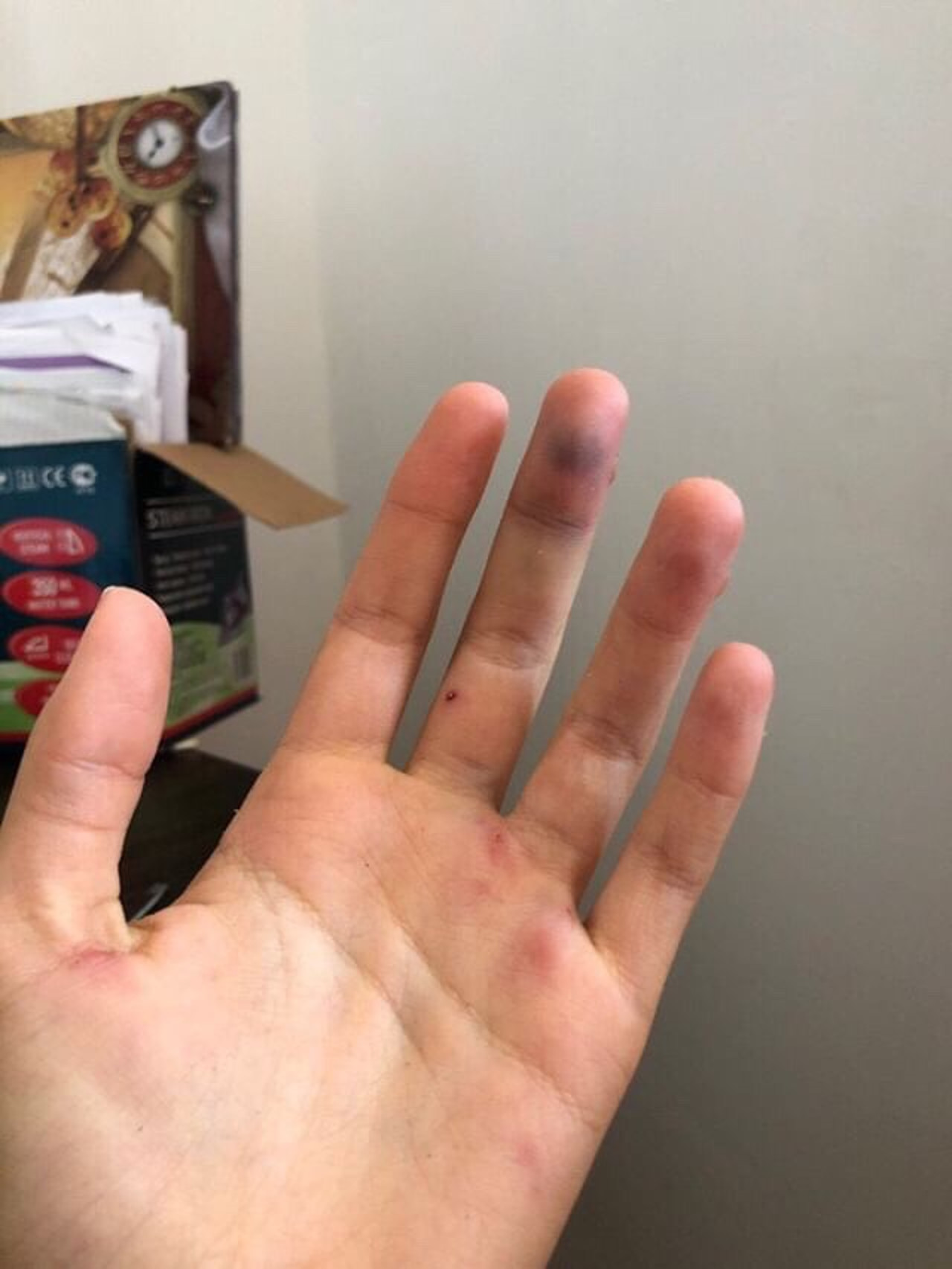 Неизвестные напали на сотрудницу тира в Анапе и разбил ей голову